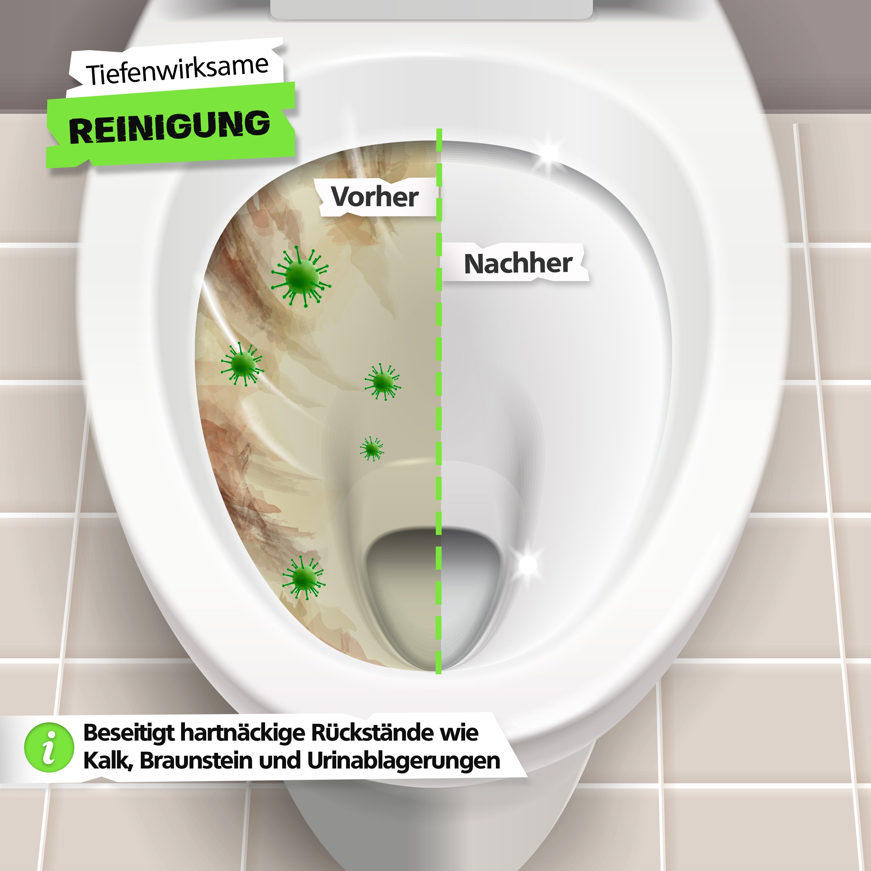 SPRINGER - HX3100 - Urinsteinentferner - Made in Germany